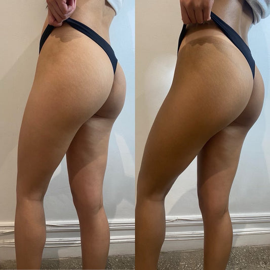 How to Achieve the Perfect Tan